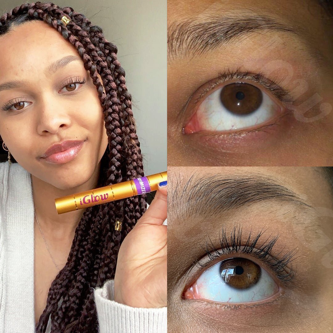 iGlow Lash &amp; Brow Maximizer + Under-eye Patches - iGlow Cosmetics